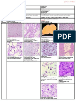 Soft Tissue Tumours