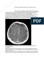 Cordia Viral Meningitis