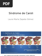 Síndrome de Caroli