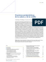 Fracturas Periprotésicas de Cadera y Rodilla 2015