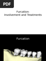 Furcation: Involvement and Treatments