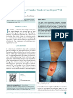 Encysted Hydrocele of Canal of Nuck: A Case Report With Review of Literature