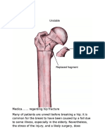 Hip Fracture