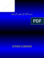 Otosclerosis