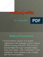 Poliomyelitis