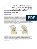 Ligamentoplastie Du LCA