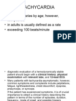 Tachycardia