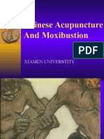 Introduction of Acupuncture