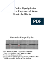 ECG Dysrhthmias III