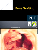 Alveolar Bone Grafting.