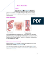 Bowel Obstruction