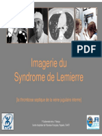 Syndrome de Lemierre PDF