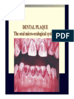 Local Plaque and Plaque Retentive Factors. 2013ppt