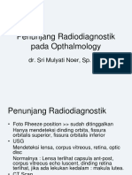 Retinoblastoma