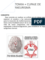 Craneotomia + Clipaje de Aneurisma PDF