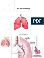 Chronic Obstructive Pulmonary Disease