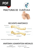 Clasificacion de Fractura de Clavicula