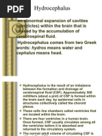 Hydrocephalus