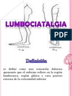 Lumbociatica