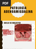 Patología Adenoamigdalina