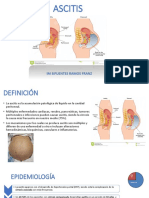 Ascitis Im Sifuentes