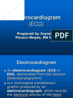 Electrocardiogram (ECG)