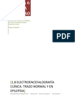 1.8 ELECTROENCEFALOGRAFÍA CLÍNICA. TRAZO NORMAL Y EN EPILEPSIA. Semana 6. Nepomuceno Severiano Yael 1235