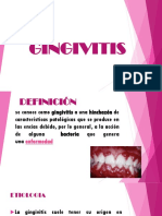 Gingivitis