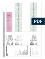 EKG Flash Cards PDF