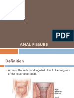 Anal Fissure