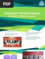 Coronas Fenestradas