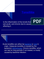 Tonsillitis