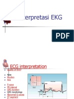 Interpretasi EKG