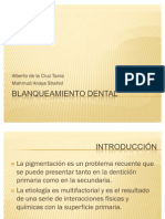 Blanqueamiento Dental