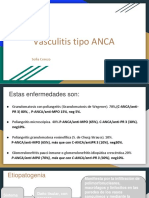 Vasculitis Tipo ANCA 