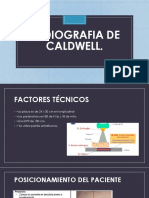 Radiografia de Caldwell