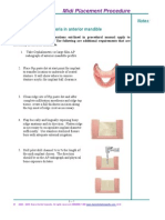 Chapter 6 Midi Implant Procedure