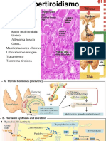 Hipertiroidismo 