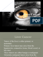 By: Vismin Prince Magno: Liver Cancer