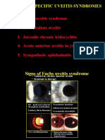 34 Idiopathic Spec Uveitis Syndrome