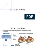 Estenosis e Insuficiencia Mitral