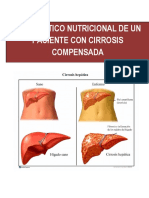 Cirrosis Hepatica