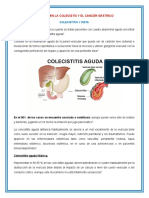 Impacto de La Dieta en Colecistitis y Cancer Gastrico