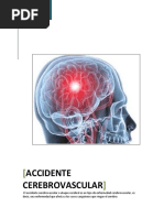 Accidente Cerebrovascular