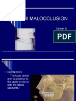 Class Ii Malocclusion: Usman & Mehmood