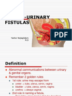 Genito-Urinary Fistulas: Yashar Najiaghdam M.D