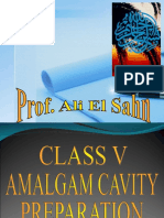 Class V Amalgam Cavity