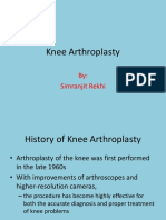 Knee Arthroplasty: By: Simranjit Rekhi