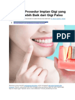 Prosedur Implant Gigi