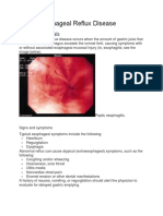 Gastroesophageal Reflux Disease